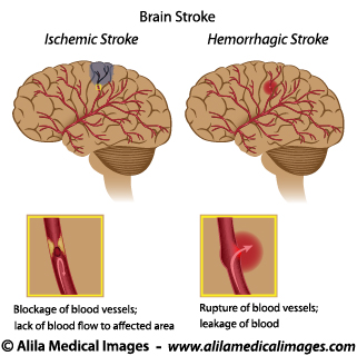 Brain and Nervous System Gallery - Medical Information Illustrated