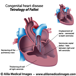 Heart, Blood and Circulation Gallery - Medical Information Illustrated