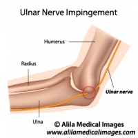 Ulnar nerve anatomy, labeled diagram.