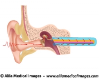 Hearing mechanism, unlabeled diagram.