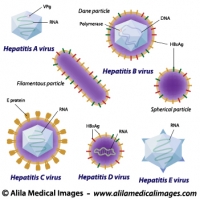 Hepatitis viruses comparison, labeled diagram.