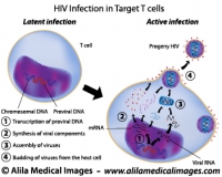 Latent and Active infection by HIV, labeled diagram.