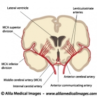 Blood supply to the brain, coronal section.