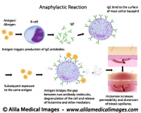 Mechanism of allergy (drug,hay fever, asthma...)