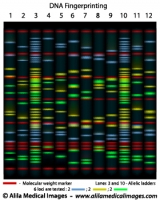 DNA fingerprinting, diagram.